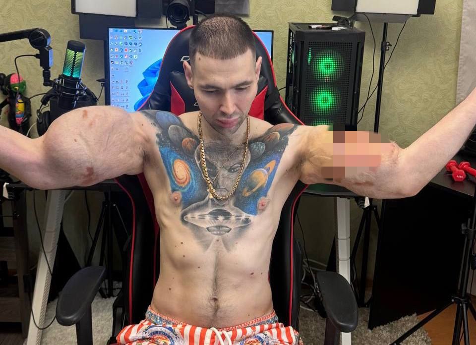     ?  -        
