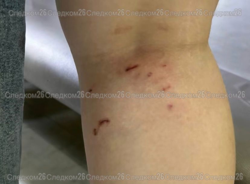 В Минеральных Водах возбуждено уголовное дело по факту нападения бродячих собак на девочку