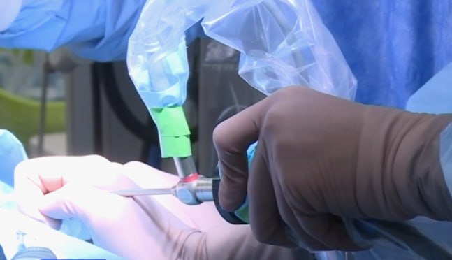 В Пятигорске хирурги удалили у пациентки опухоль диаметром 40 сантиметров