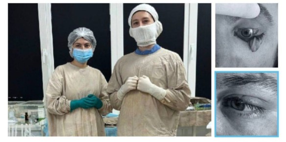 В Пятигорске врачи восстановили пациенту оторванное веко