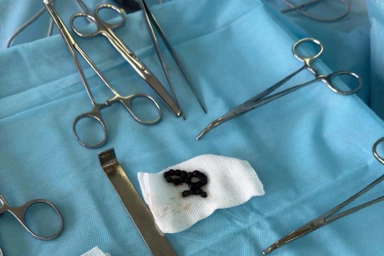 В Ставрополе трехлетний мальчик проглотил 18 магнитов В Ставрополе трехлетний мальчик проглотил 18 магнитов