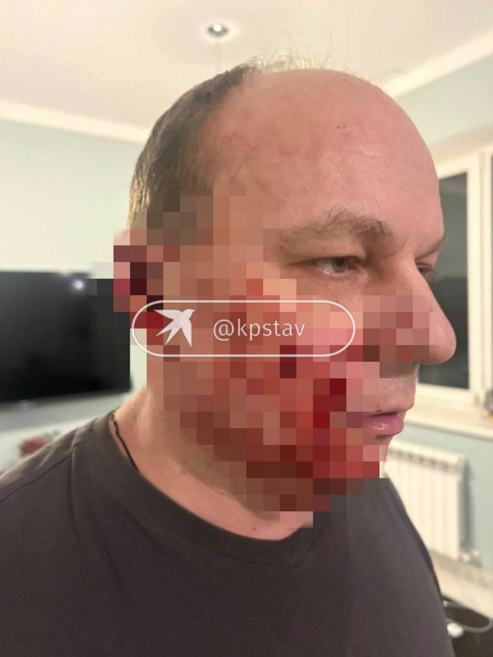 В Ставрополе на мужчину напал пес породы американская акита