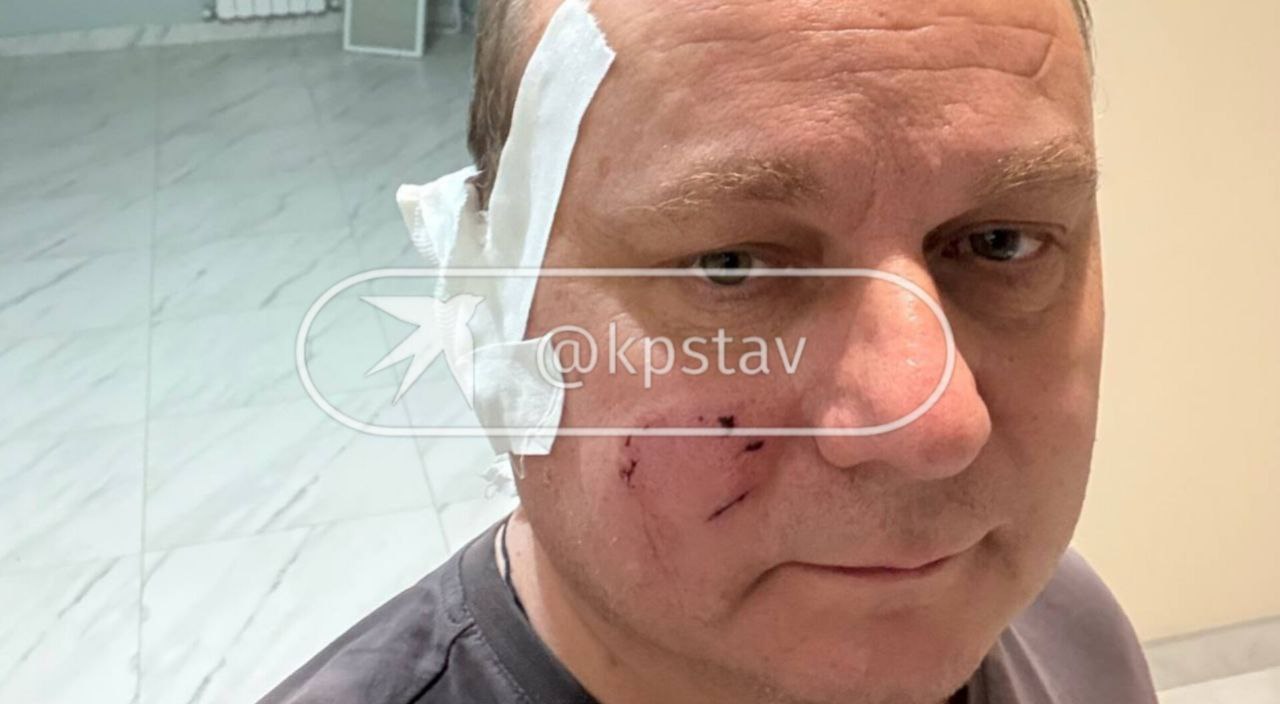 В Ставрополе на мужчину напал пес породы американская акита В Ставрополе на мужчину напал пес породы американская акита