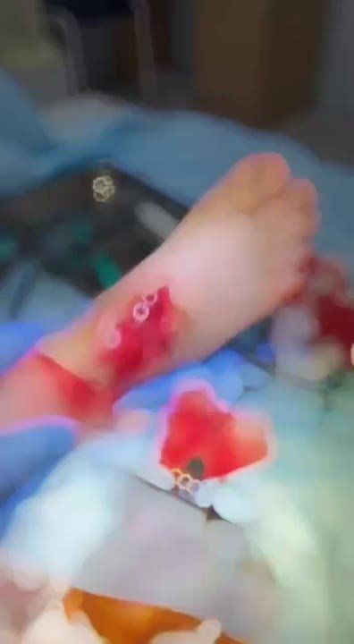 ��������������� ���� �� ������� ���� ��-�� ��������