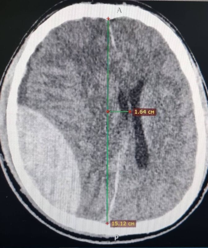 � ���������� 30-������ ������� �������� ��������, �� ����� � �� ���������