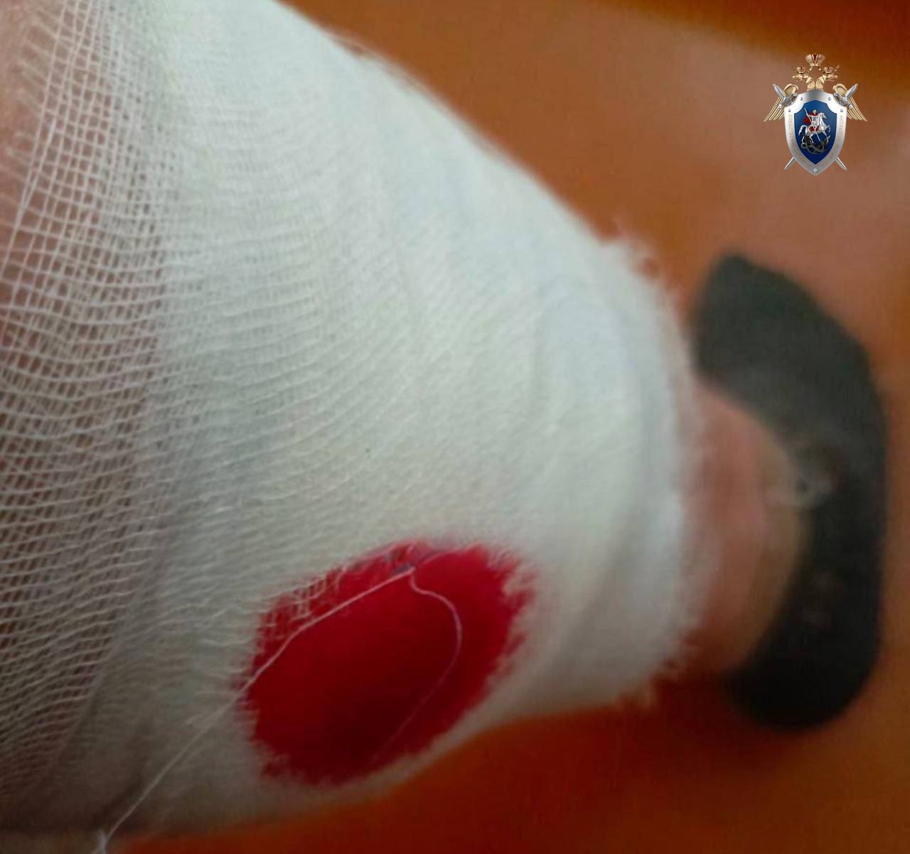 И.о. руководителя регионального управления СКР поручил возбудить уголовное дело по факту нападения собак на женщину в Минеральных Водах