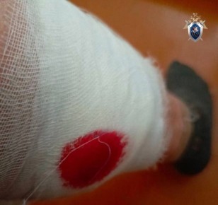 Собаки покусали жительницу Минвод