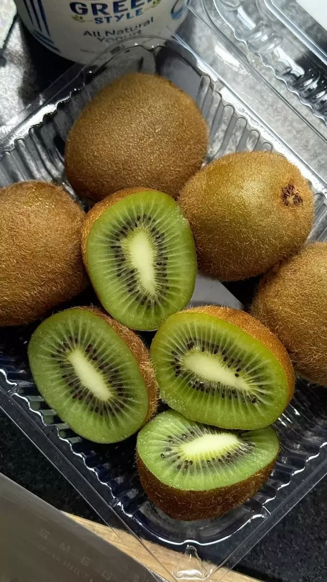 Спасение сосудов и кишечника: как киви может изменить ваше здоровье