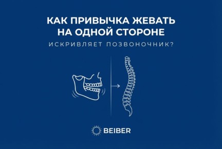 ��� ������������� ������� ������ �� �������� ������������