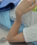 ОСТОРОЖНО, ЖЕСТЬ!. Сложный перелом руки получил юный электросамокатчик в Пятигорске Последствиями неаккуратной поездки поделились в местной ГКБ