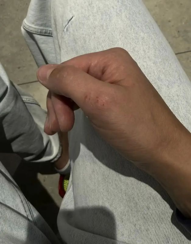«В упыря пока не превратилась»: в квартиру ставропольчанки залетела летучая мышь и укусила за руку «В упыря пока не превратилась»: в квартиру ставропольчанки залетела летучая мышь и укусила за руку